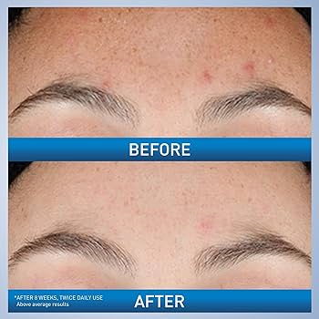 ''CeraVe Renewing Retinol Face Wash''