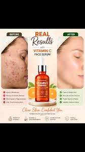 ''Yardco Vitamin C Face Serum''