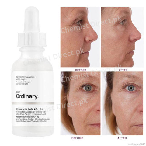 ''The Ordinary Niacinamide''